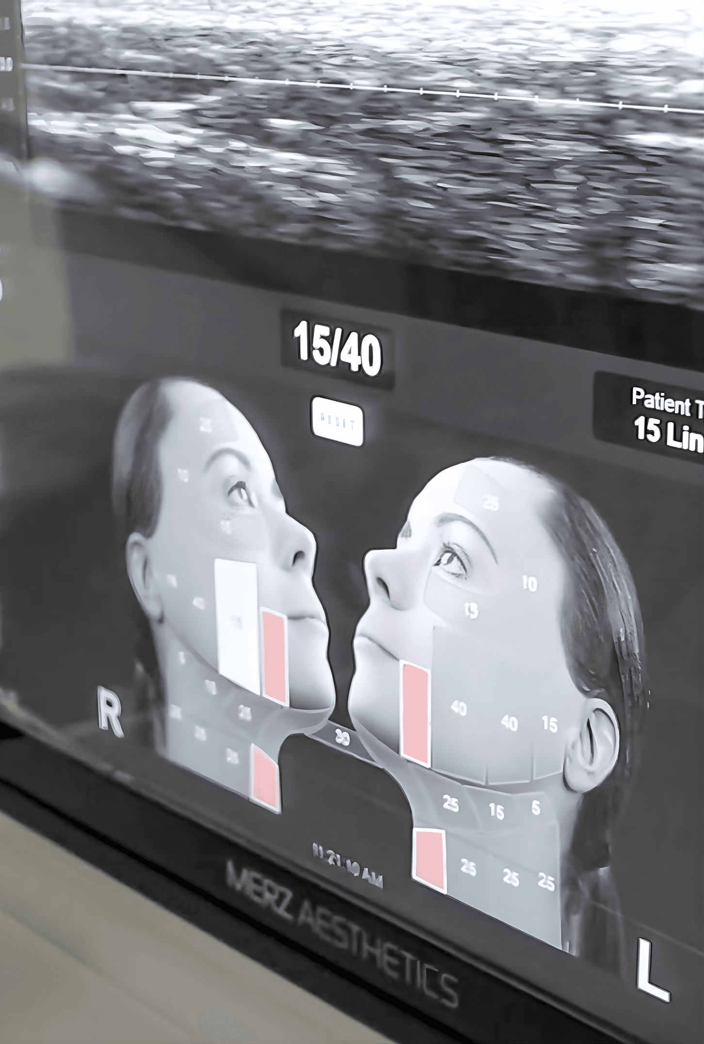 DeepSEE Ultrasound Visualization Technology